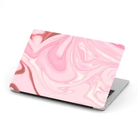 Macbook Hard Shell Case - Pink Marble